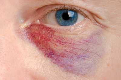 Ten Ways to Prevent Eye Injuries at Work